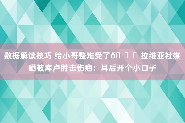 数据解读技巧 给小哥整难受了😅拉维亚社媒晒被库卢肘击伤疤：耳后开个小口子